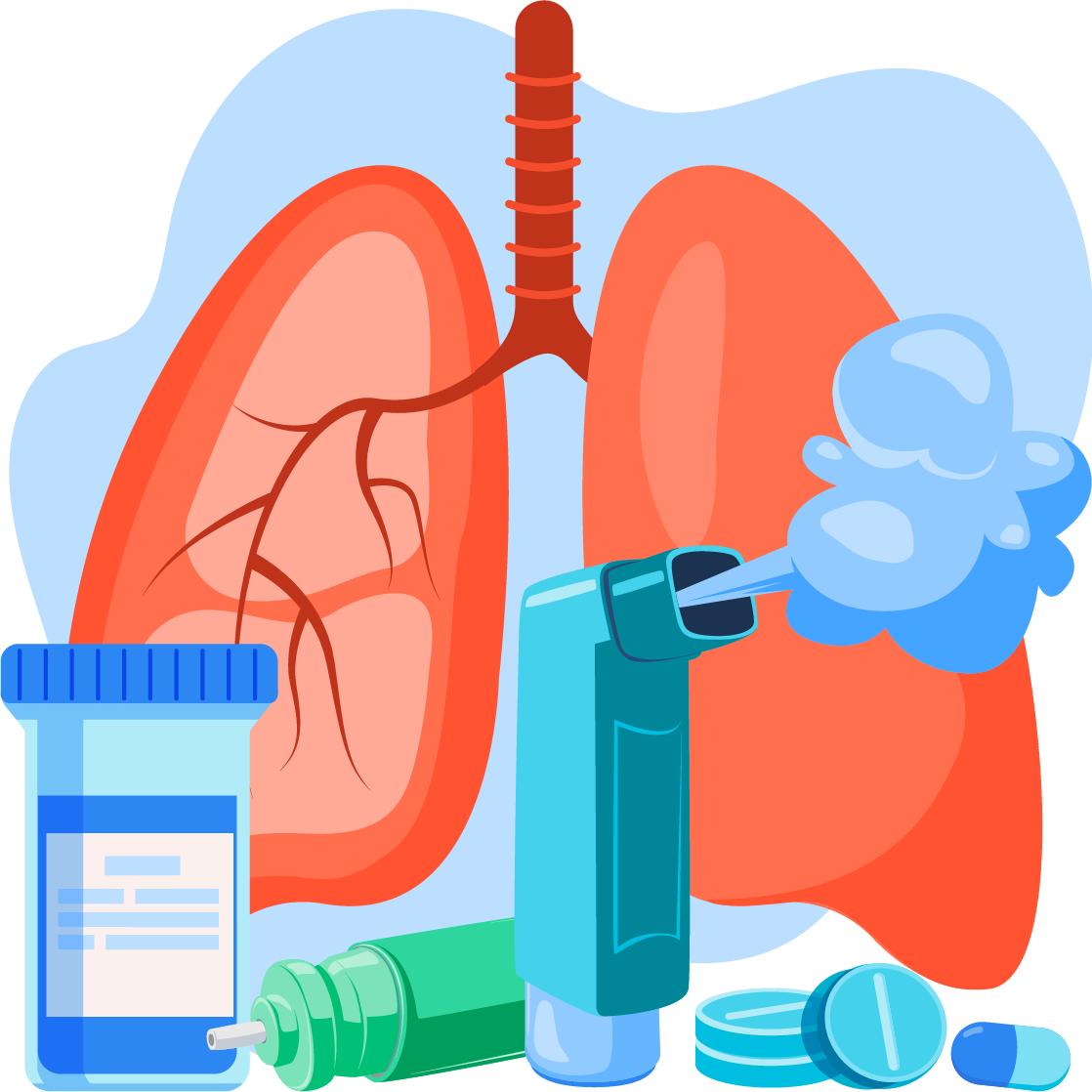 Managing Asthma